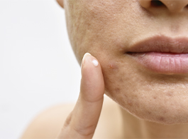 Fisiopatologia das desordens cutâneas